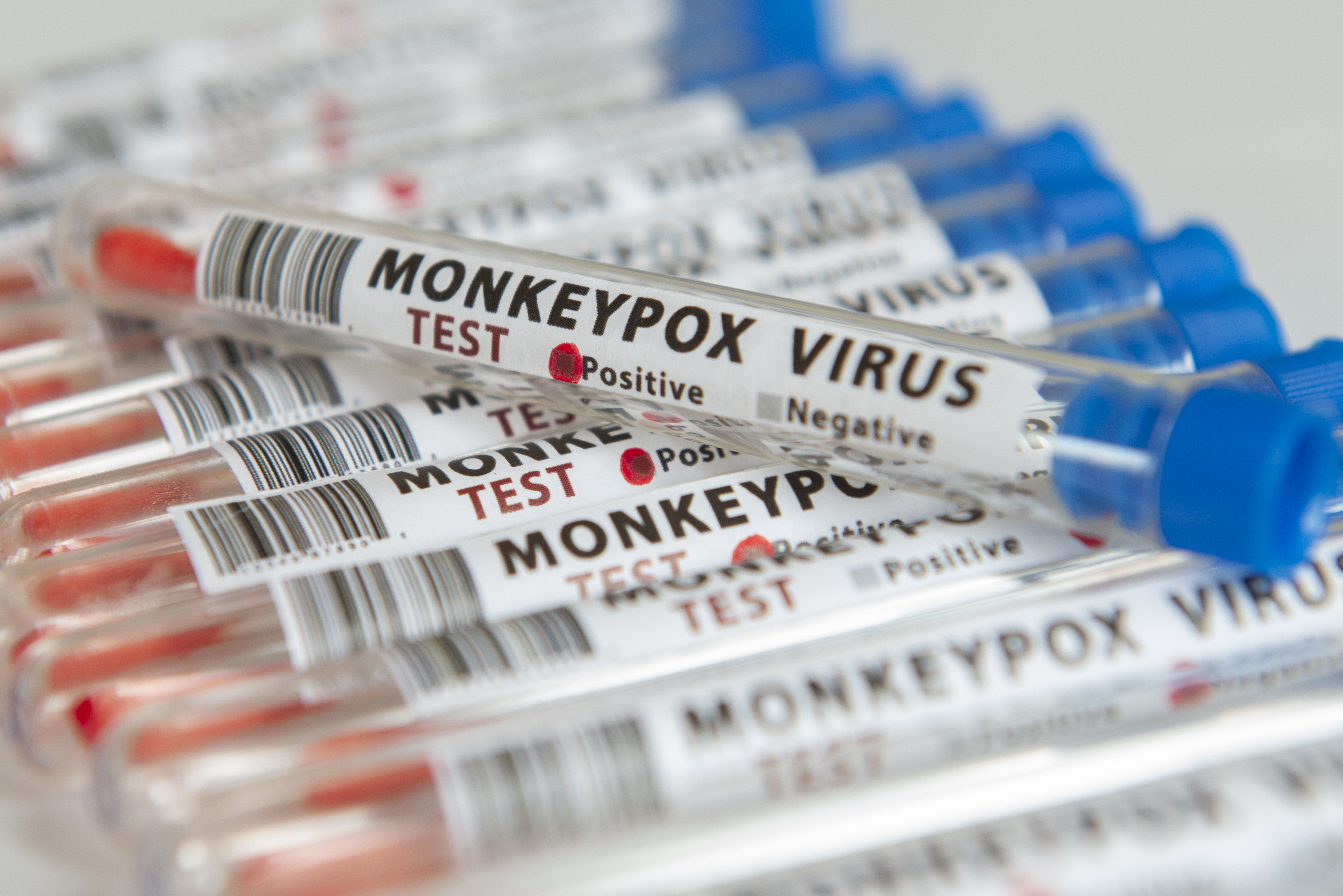 How Colleges Can Prepare For — and Prevent — Monkeypox Outbreaks - Vimarsana News